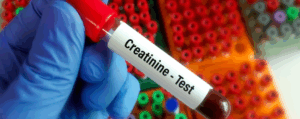 Κρεατινίνη