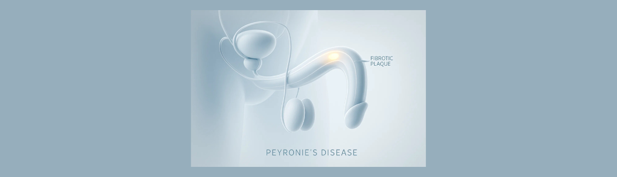 νόσος peyronie